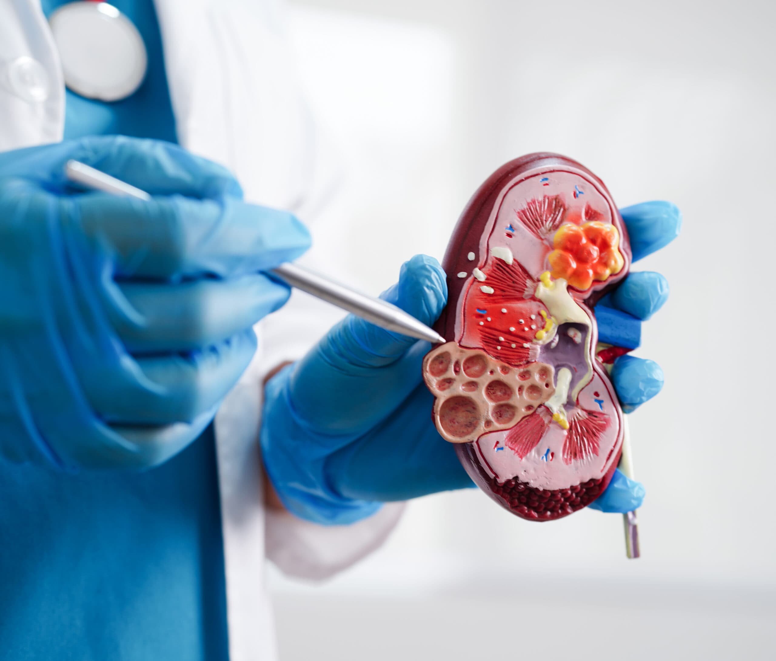 Best Kidney Transplant Hospital in Chamrajpet – Where Quality Care Meets Medical Excellence