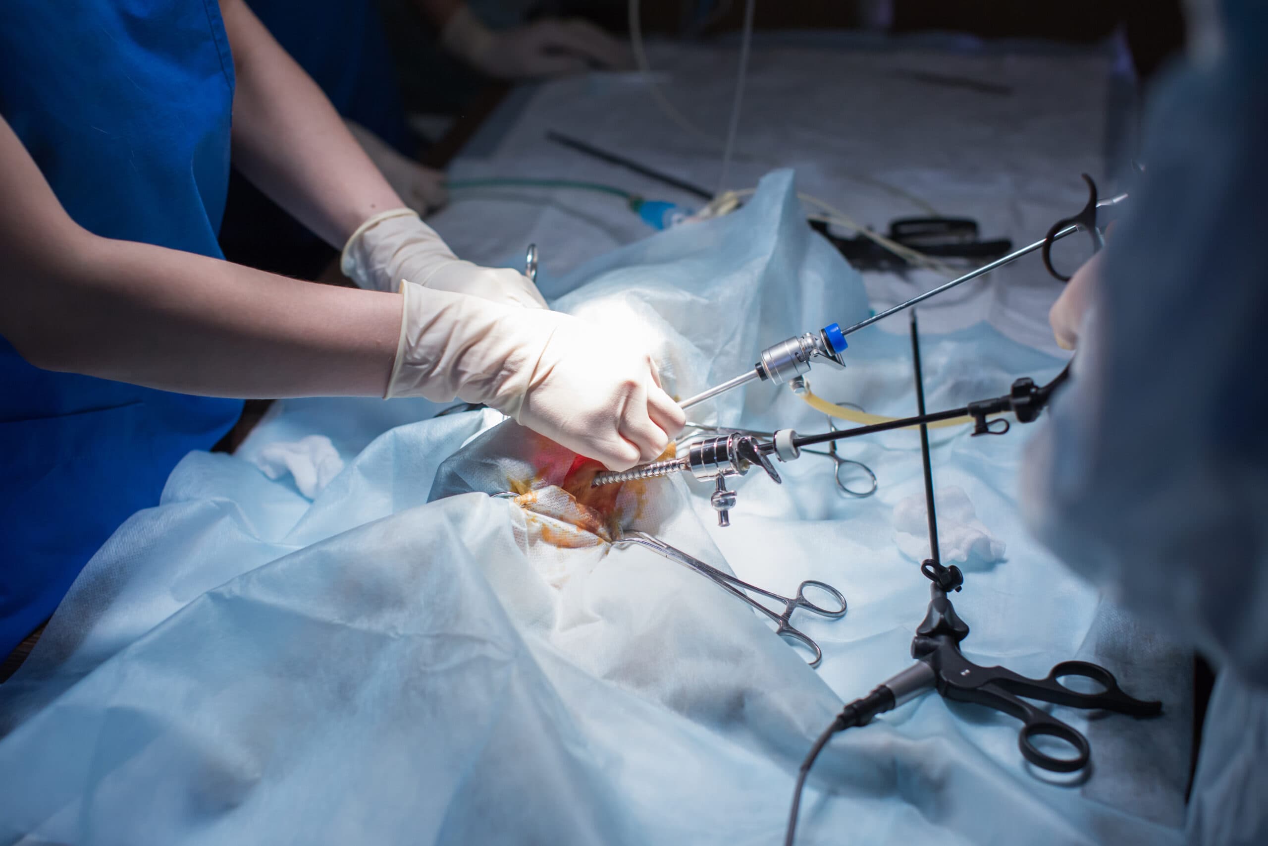 Revolutionizing Surgical Care with Minimally Invasive Expertise in Chamrajpet