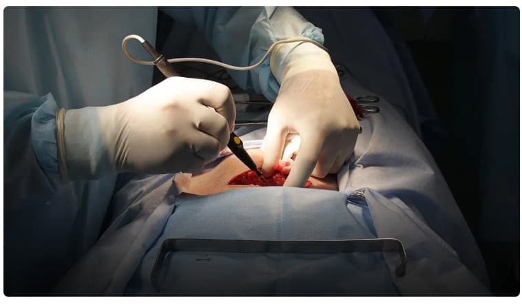 Dr. Niyaz Ahmed – Expert General Surgeon at Leading General Surgeon Hospital in Banashankari & Chamrajpet