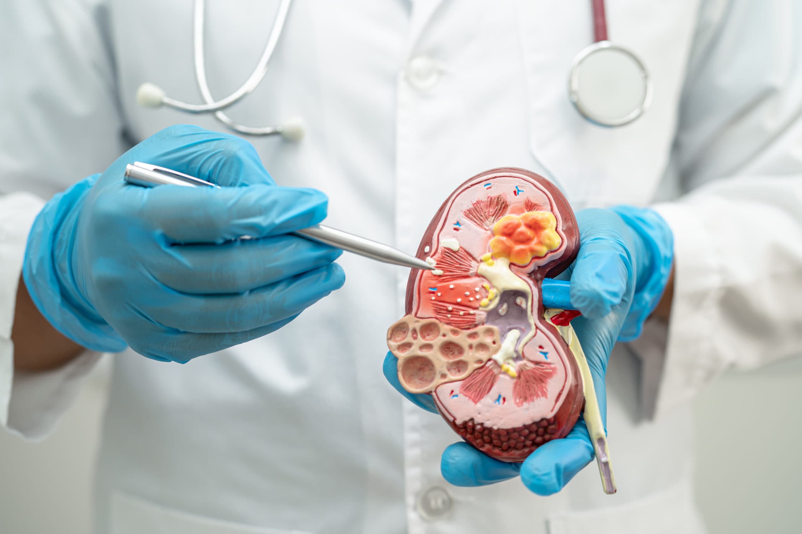 Comprehensive Kidney Care and Advanced Renal Treatment Services