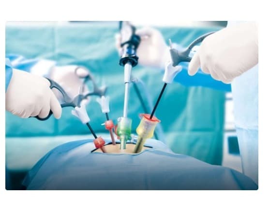 Best Laparoscopy Hospital In Bangalore: Advanced Minimally Invasive Surgical Care