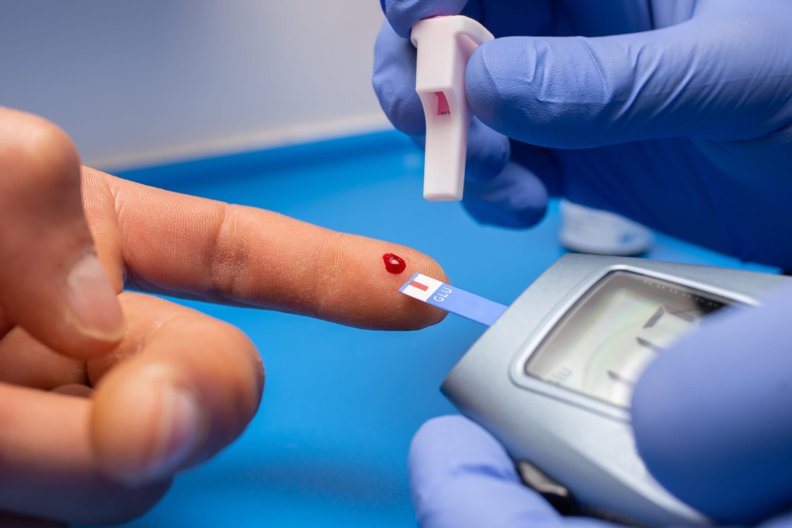Best Diabetologist in Chamrajpet, Bangalore — Dr. Sandeep S Reddy